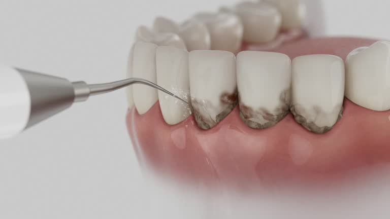 Reliable Dental Implants contractor in Wacousta, MI by Smile Center Dentistry